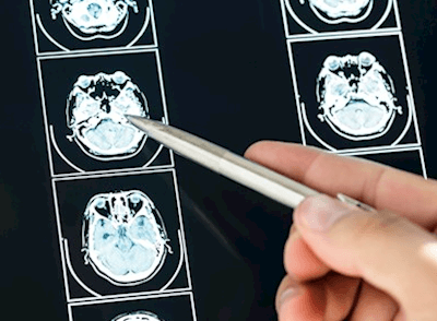 Practice Spotlight - Functional Cognition Explained