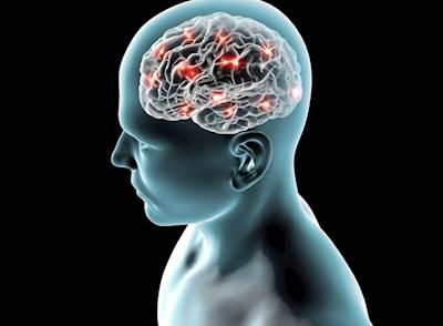 Acquired Brain Injury – The OT role in an individualised, client directed approach to rehabilitation