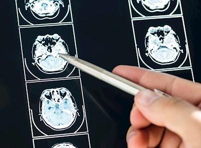 Practice Spotlight – Functional Cognition Explained